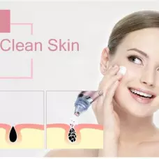 Вакумен уред за почистване на пори и черни точки XN-8030 Вакумен уред за почистване на пори и черни точки XN-8030