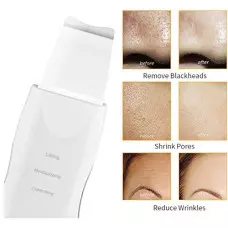 Ултразвукова шпатула за почистване на MUYE 8815 Ултразвукова шпатула за почистване на MUYE 8815